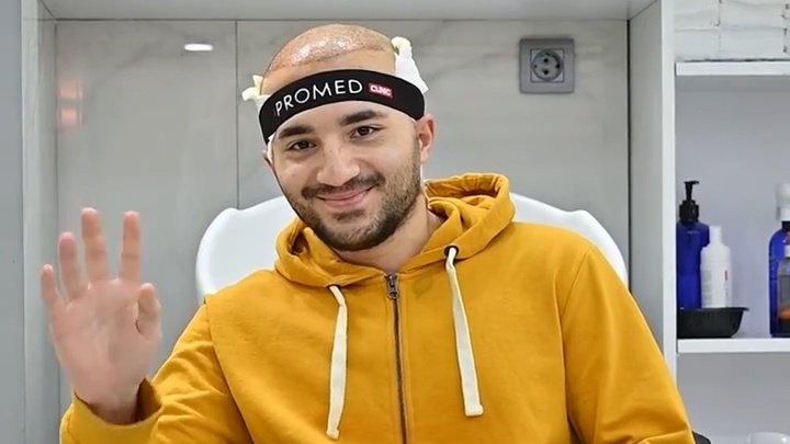 مقابلة زراعة الشعر — عميل مصري